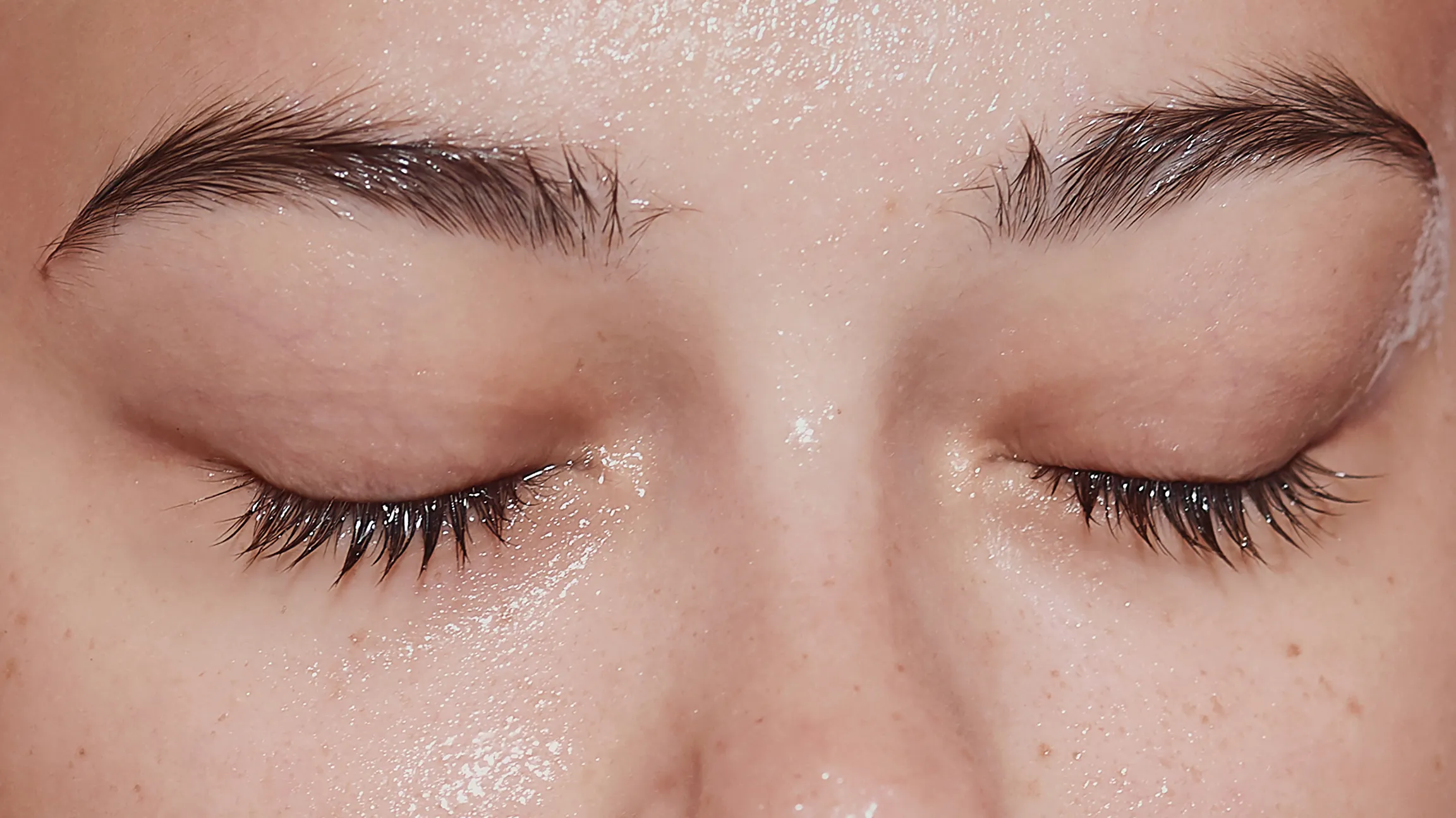 How Does Hypochlorous Acid Spray for Eyes Actually Work?